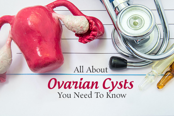 Ovarian Cysts