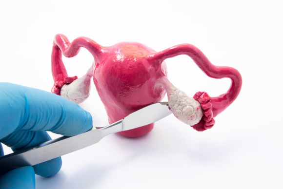 Minimally Invasive Gynecological Surgery