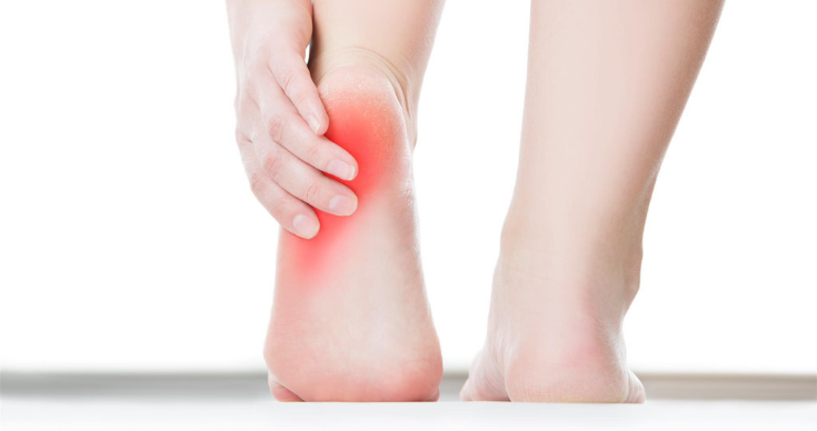 Diabetic Foot