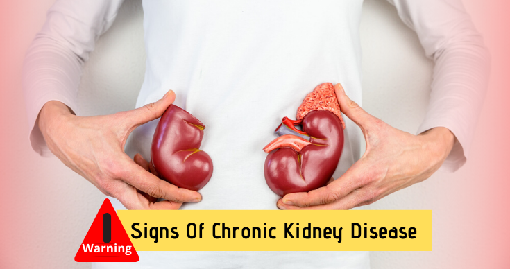 Signs Of Kidney Disease